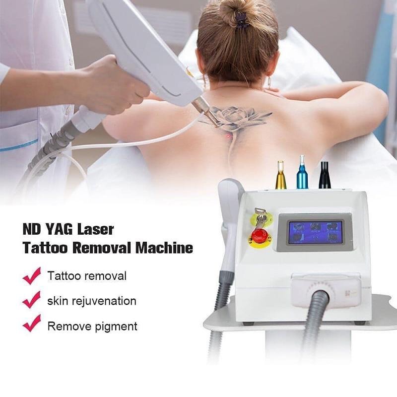 ND:YAG TATTOO REMOVAL LASER