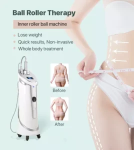 ball-roller-therapy