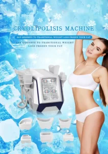 cryolipolisis-machine