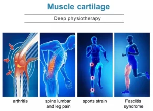 muscle-cartilage