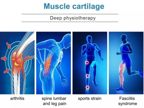 EMS Muscle and Physiotherapy Machine product image